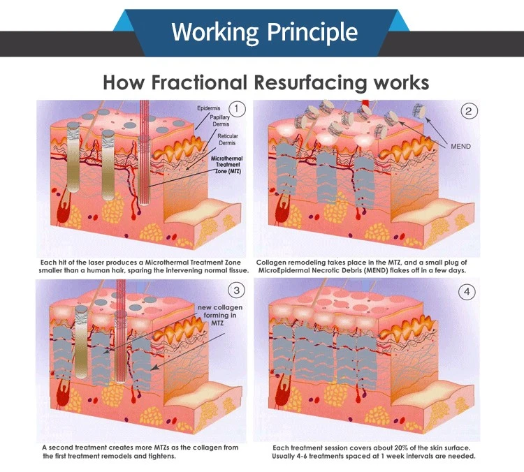co2 fractional theory