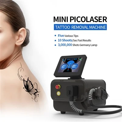 Laser voor tattoo-verwijderingsapparaat