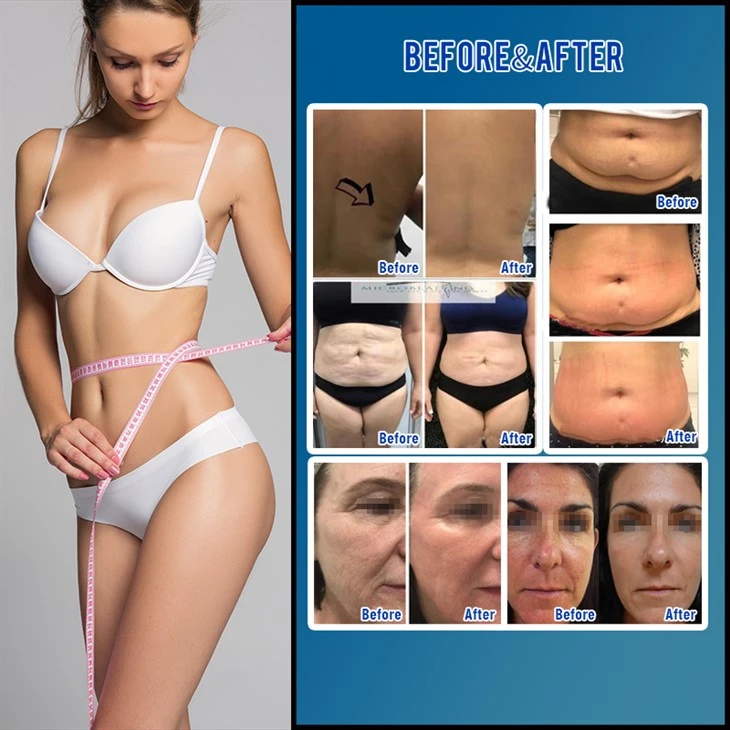 New Vacuum Cavitation body sculpting Machine