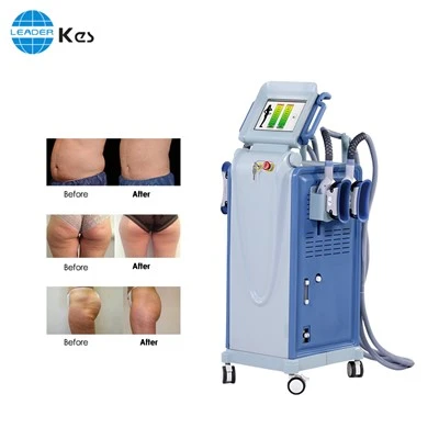 Cryo vetreductiemachine